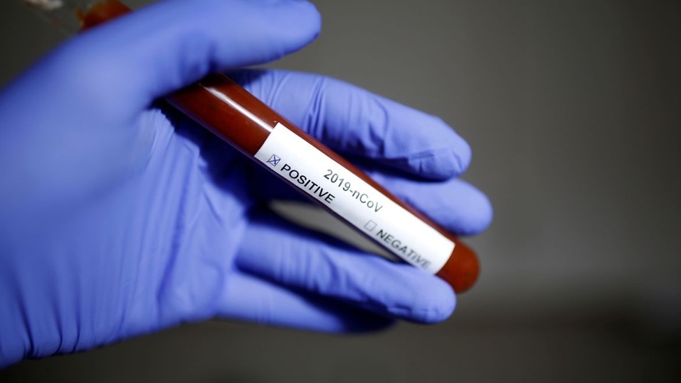 Koronavirüs salgınında can kaybı 356'ya yükseldi