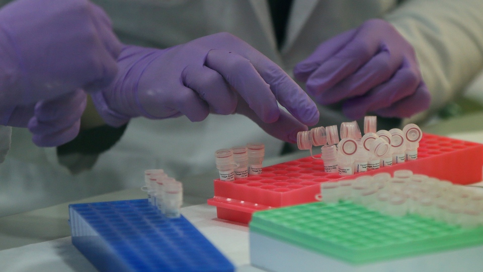 Tanı kiti ithalatında 'uygunluk yazısı' şartı