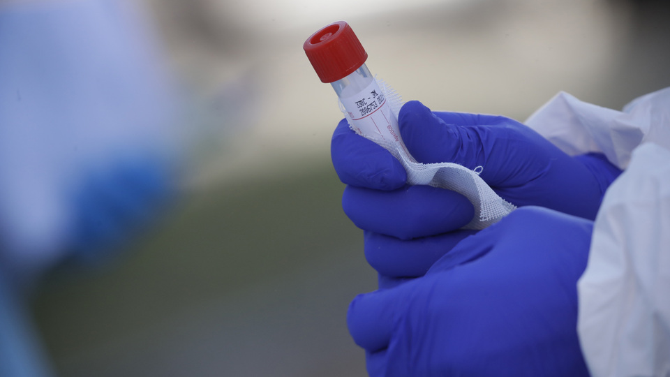 ABD'den onay! 15 dakikada sonuç veriyor...