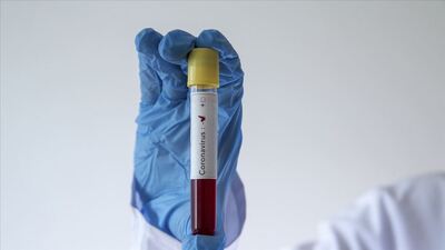 Koronavirüs salgınında can kaybı 501'e yükseldi