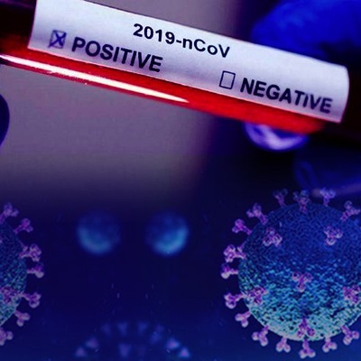 Erkeklerin daha çok ölmesi bu riske bağlı olabilir!