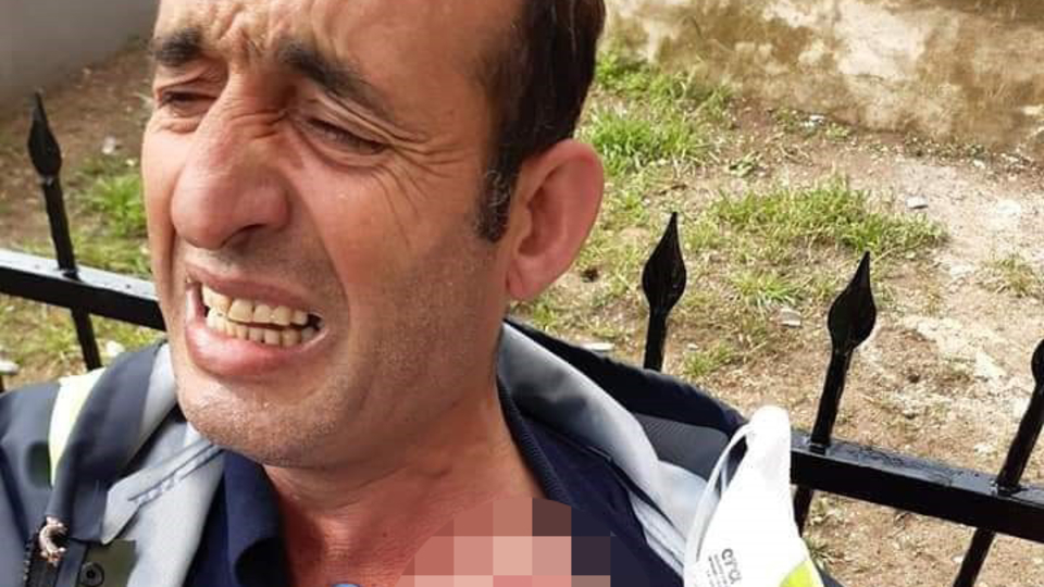 Dezenfeksiyon çalışması yaparken saldırıya uğradı!