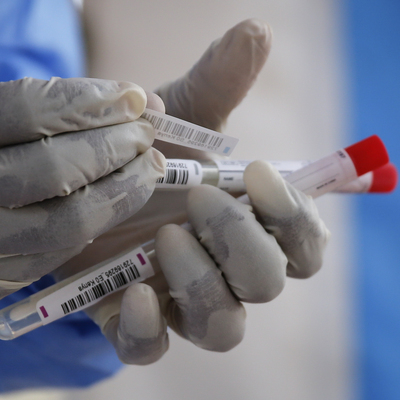 Bakan açıkladı! Araştırmacıya 6 bin TL burs