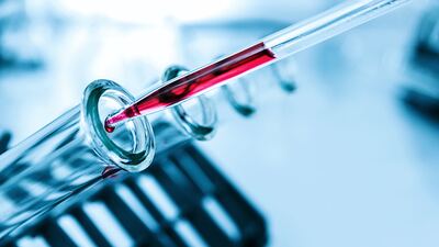 Sene başı 1 koyan 17.5 aldı