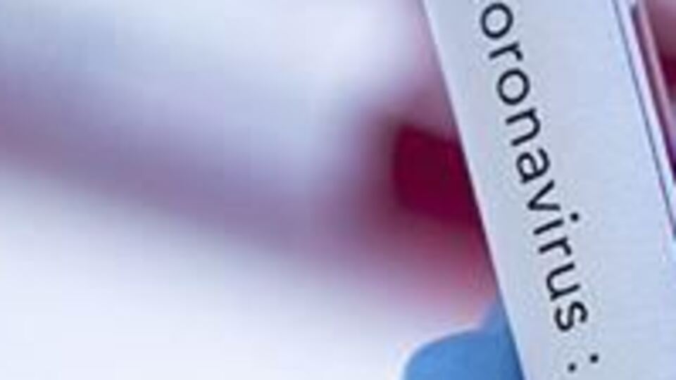 Yerli test kiti geliştiriliyor