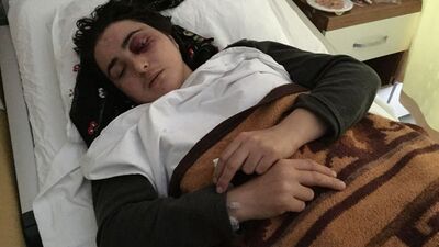 Oklavayla eşini kör etmişti! Şoke eden savunma!