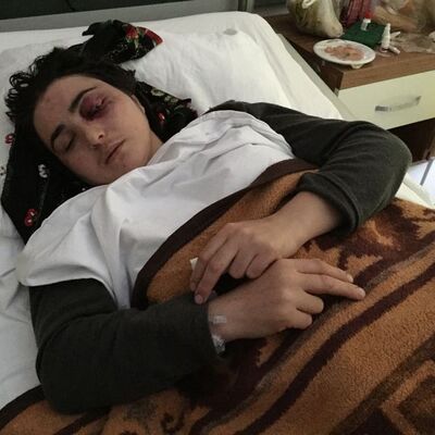 Oklavayla eşini kör etmişti! Şoke eden savunma!