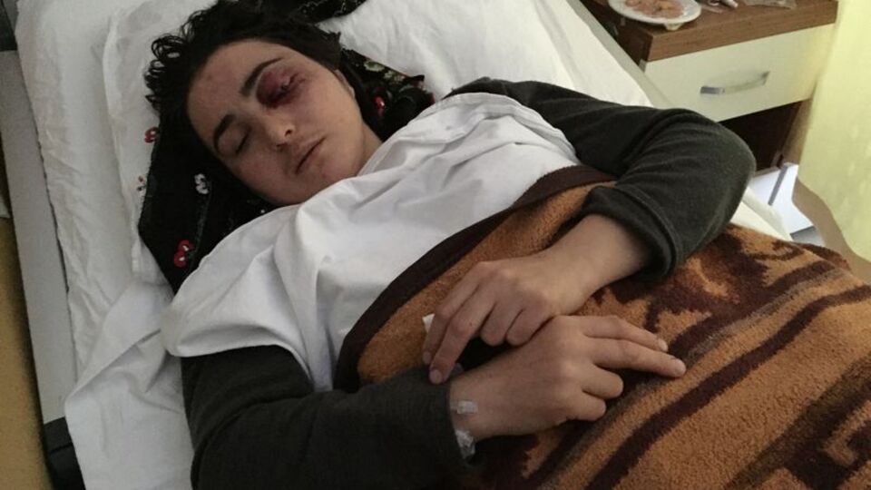 Oklavayla eşini kör etmişti! Şoke eden savunma!