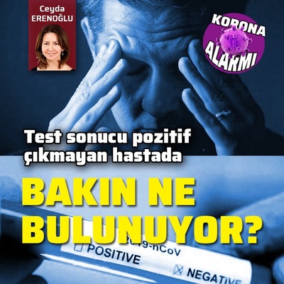 Test sonucu pozitif çıkmayan hastada bakın ne çıkıyor?