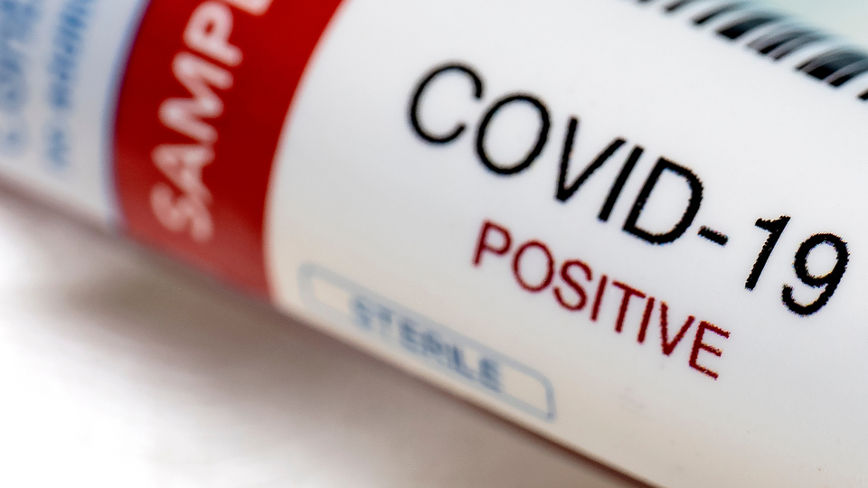 Koronavirüs etkisini yarasalarda geliştirdi