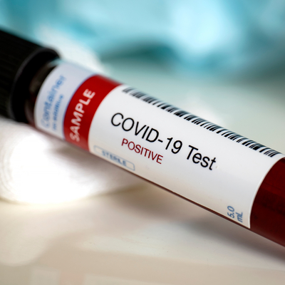 Koronavirüs salgınında can kaybı bin 296'ya yükseldi