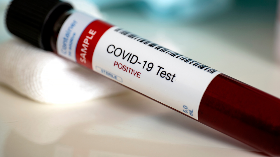 Koronavirüs salgınında can kaybı bin 296'ya yükseldi