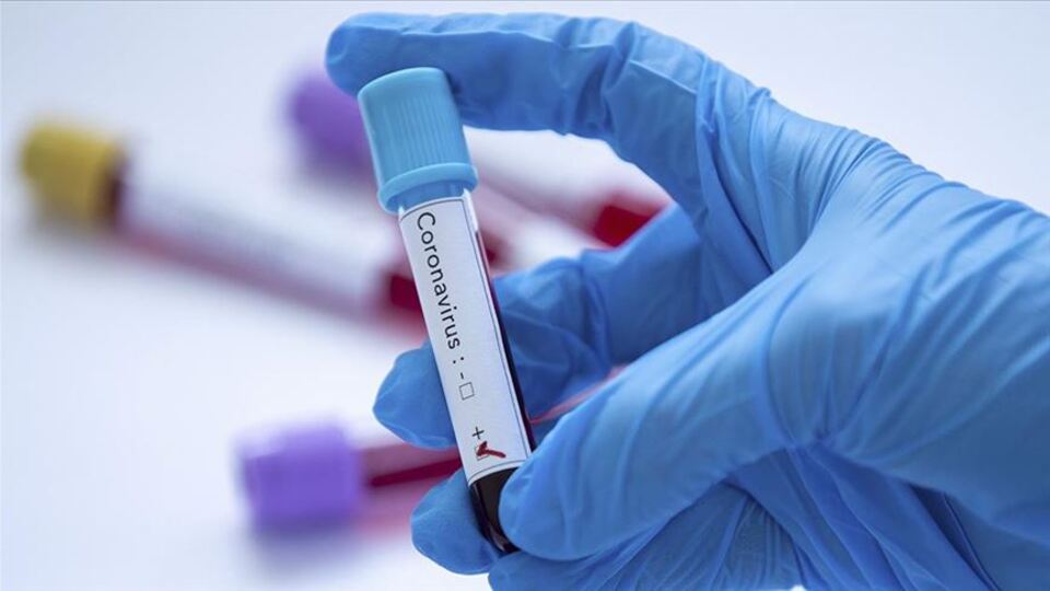 Başhekimin testi pozitif çıktı