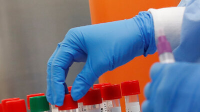 Salgına çözüm getirene 180 bin TL ödül