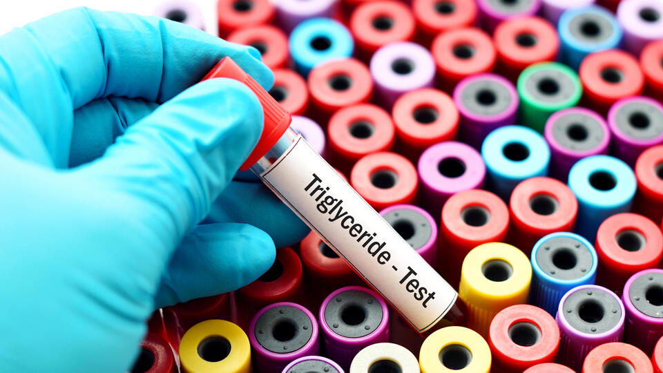 Trigliserit seviyesinin düşmesi için yapılması gerekenler