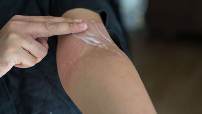 Krem sürmek orucu bozar mı?