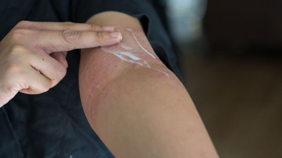 Krem sürmek orucu bozar mı?