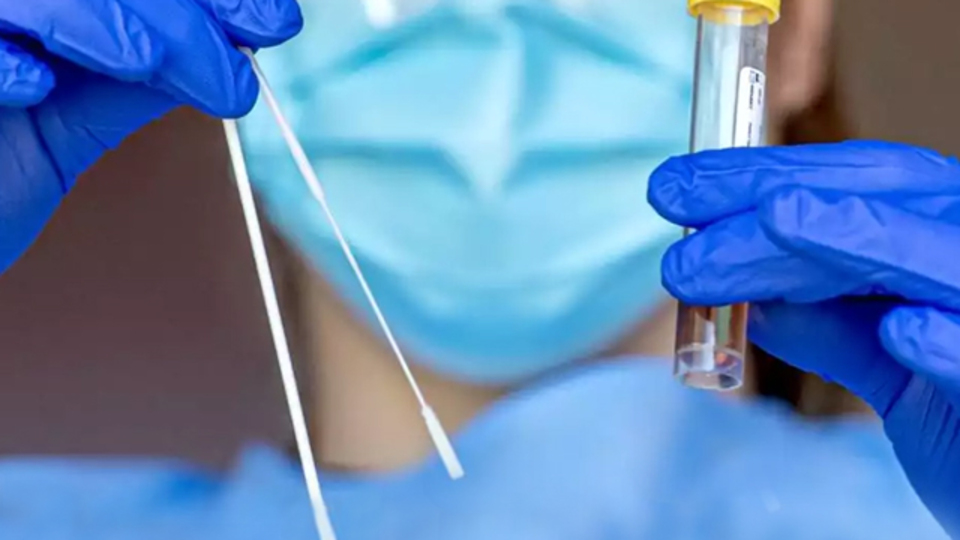 Koronavirüs salgınında can kaybı 3174'e yükseldi