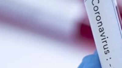 Koronavirüs salgınında vaka sayısı 2 binin altına düştü