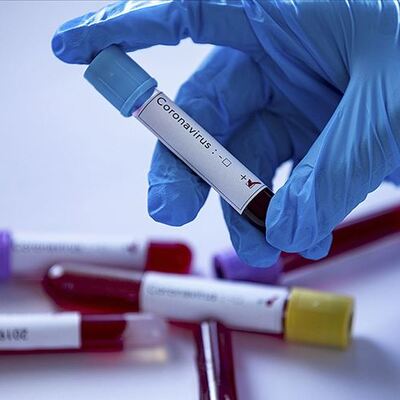 Koronavirüste obezite tehlikesi