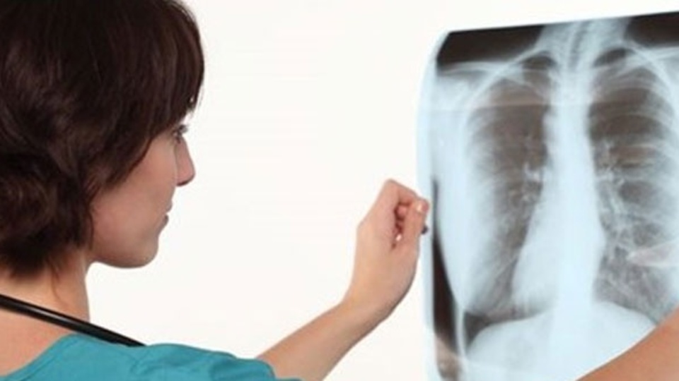 Tüberkülozun teşhisi ve tedavi yöntemleri