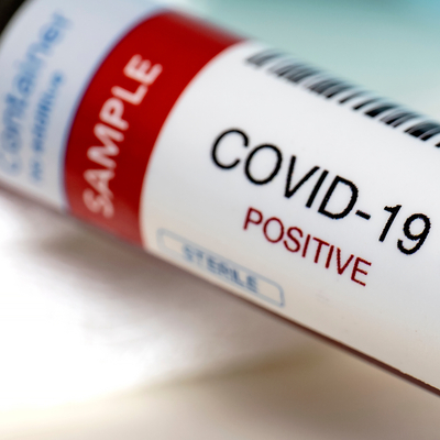 Erkekler koronavirüsten daha çok etkileniyor! İşte nedeni...