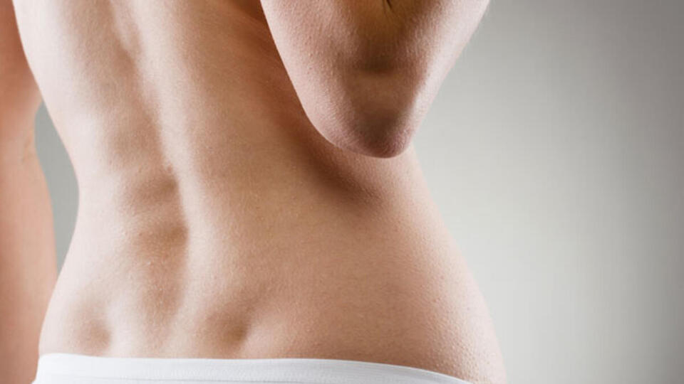 Omurga eğriliğinin (skolyoz) oluşma nedenleri