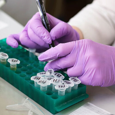 İngiltere’den yüzde 100 doğruluk payı olan koronavirüs testi