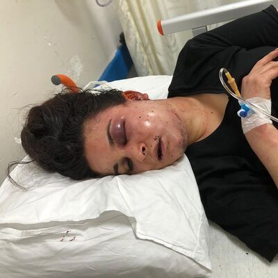 8 saat işkence göre kadın dehşeti anlattı