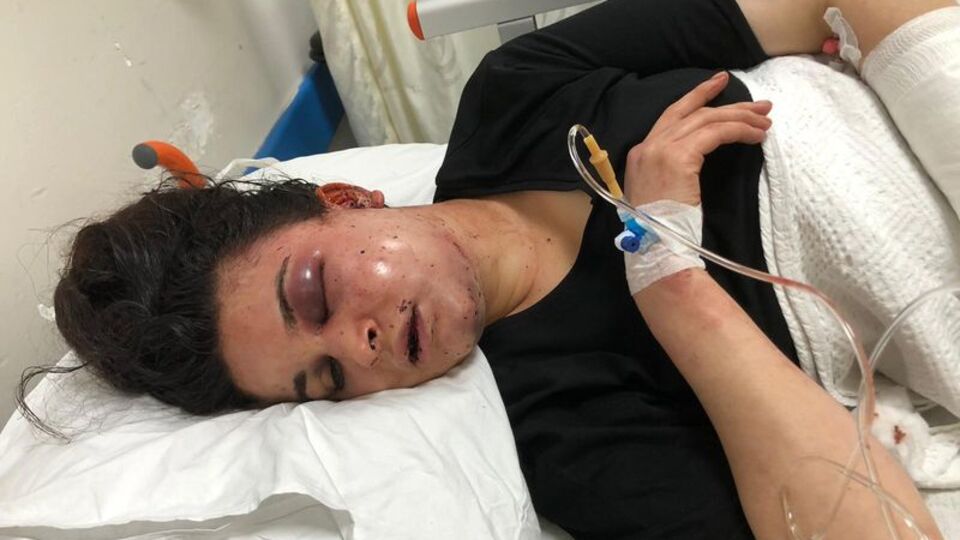 8 saat işkence göre kadın dehşeti anlattı