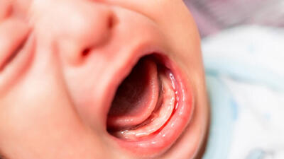 Kawasaki hastalığı nedir?