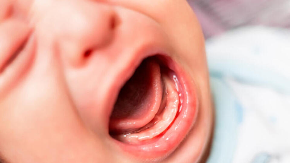 Kawasaki hastalığı nedir?