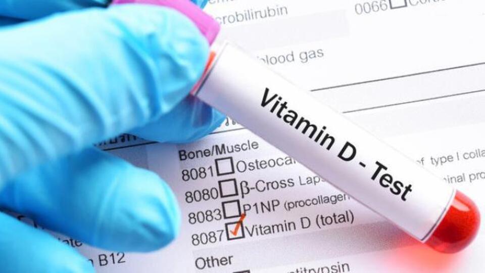 25-Hidroksi D vitamini testinde değerler ve belirtiler