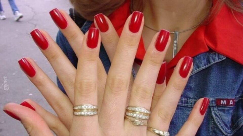 El ve ayaklarda 6 parmaklılık