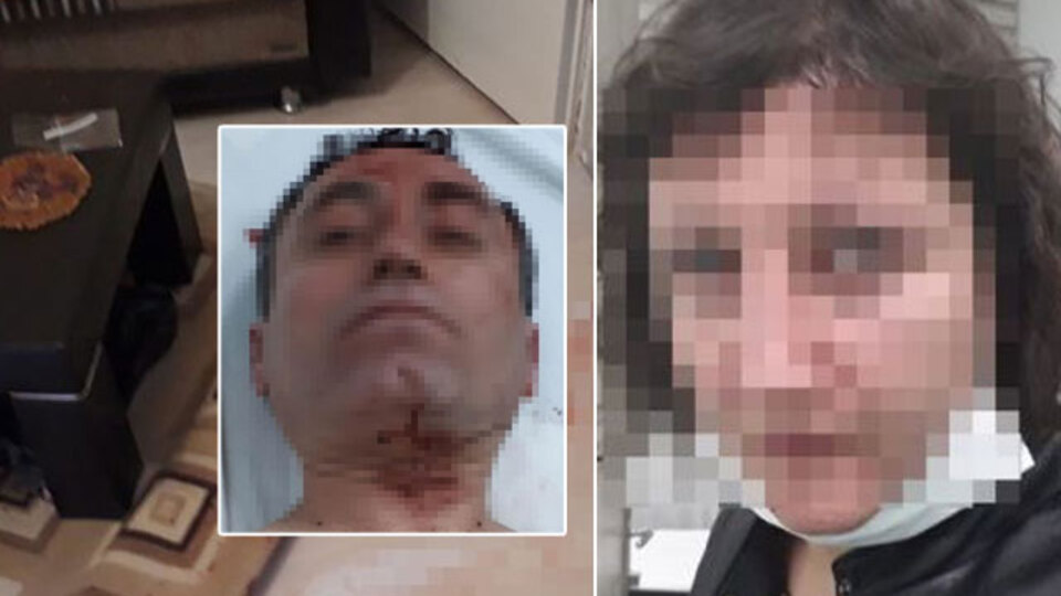 Kafasında şişe kırıp bıçakladı! Dehşet gecesi!