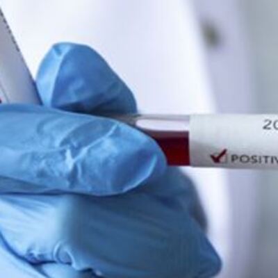 Kovid-19'dan iyileşenlerin sayısı 127 bine yaklaştı