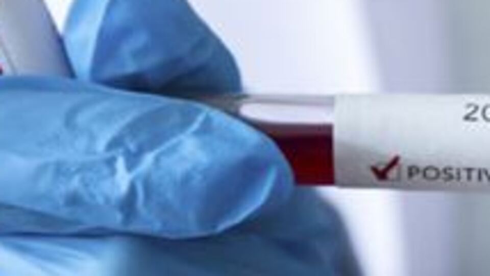 Kovid-19'dan iyileşenlerin sayısı 127 bine yaklaştı