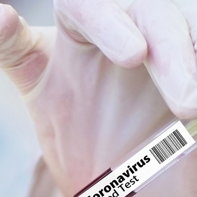 Koronavirüs salgınında bugün 25 kişi hayatını kaybetti