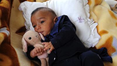 Mucize bebek Ömürhan hayata tutundu