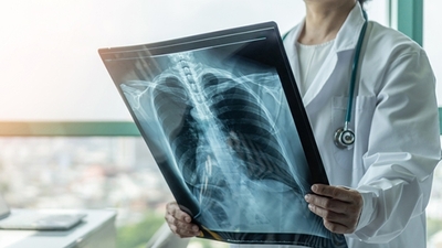 Kronik hastalıklar nelerdir?