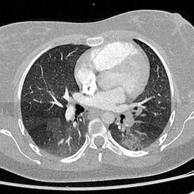 Fransa'dan kritik koronavirüs açıklaması!