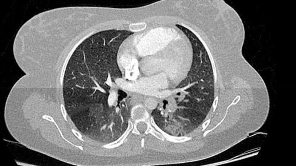 Fransa'dan kritik koronavirüs açıklaması!