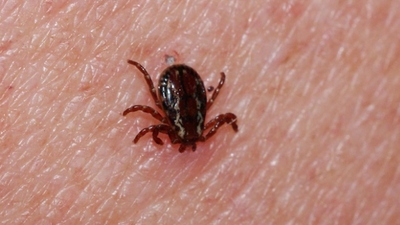 Kırım Kongo Kanamalı Ateşi (KKKA) nedir?