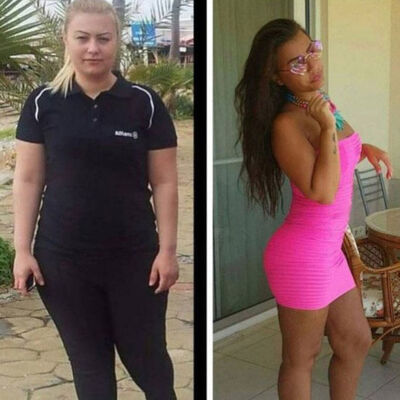 9 yılda 22 estetik için 240 bin TL harcadı!