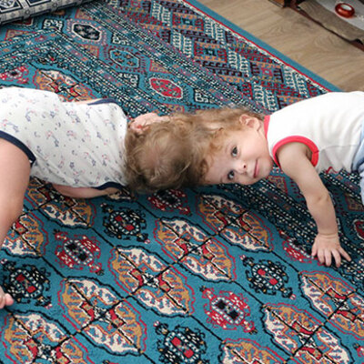 Antalyalı siyam ikizleri İngiltere'de ayrıldı