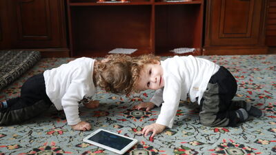 Ayrılan siyam ikizleri Türkiye'ye döndü