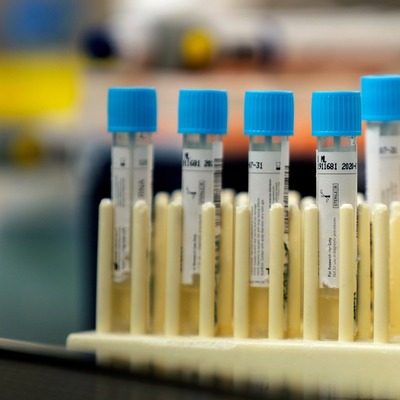 Koronavirüs salgınında bugün 1021 hasta daha iyileşti