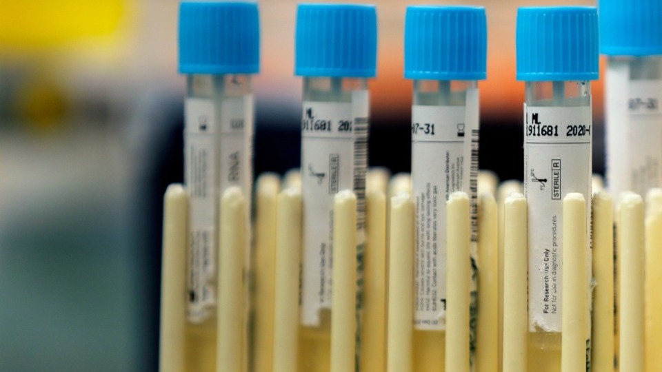 Koronavirüs salgınında bugün 1021 hasta daha iyileşti