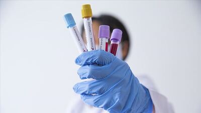 Şanlıurfa Valisi Erin: Pozitif vaka sayısı hızla yükselmeye başladı