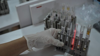 Koronavirüs salgınında bugün yeni vaka sayısı 1562 oldu